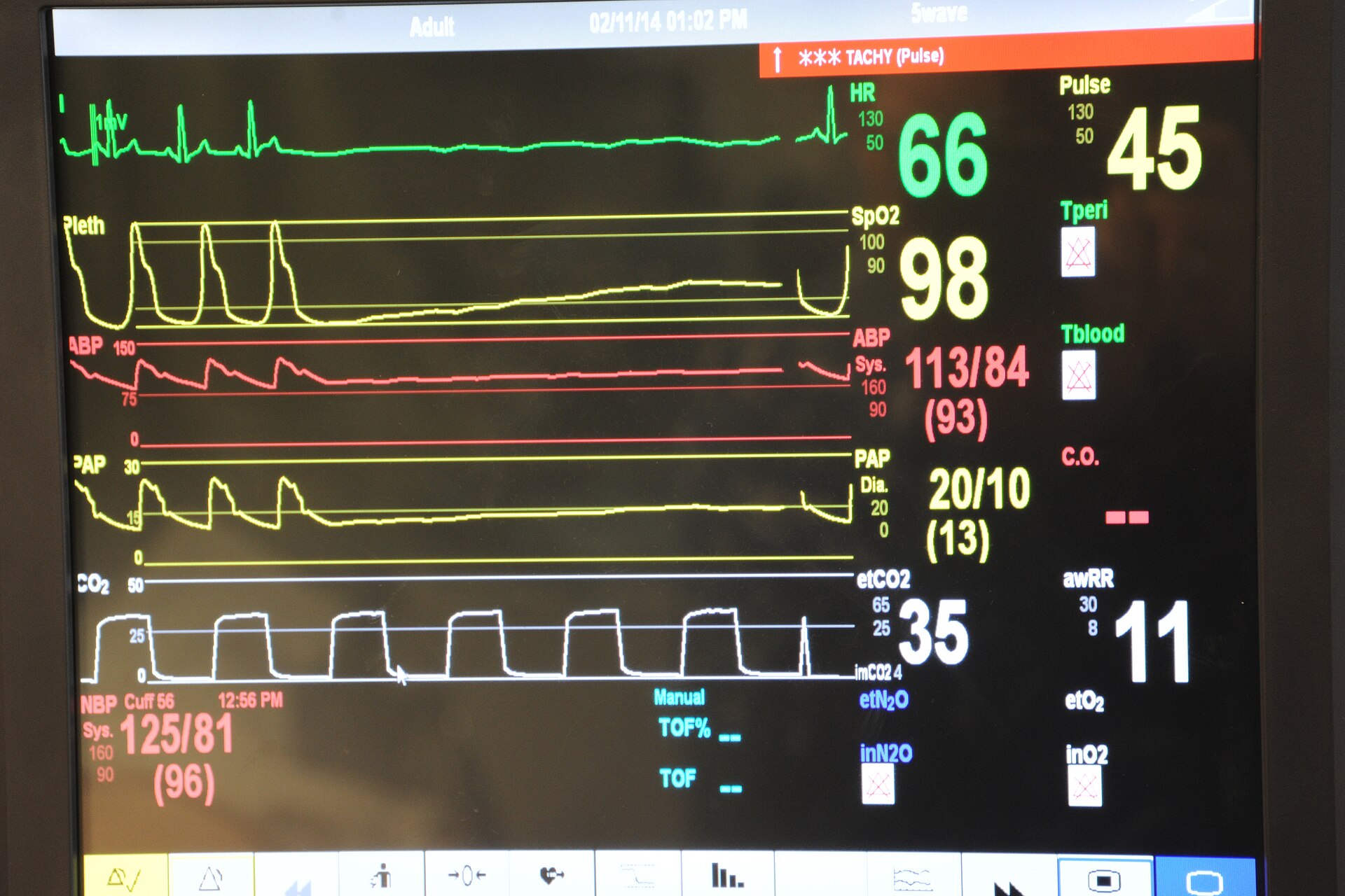 Medical monitoring equipment precision components